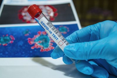 Na koronavirus se u županijskom Zavodu za javno zdravstvo možete testirati na vlastiti zahtjev